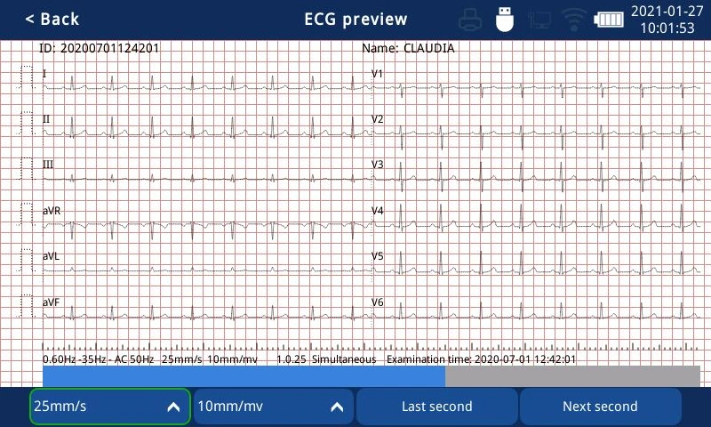 intelligent 3 channel ECG machine